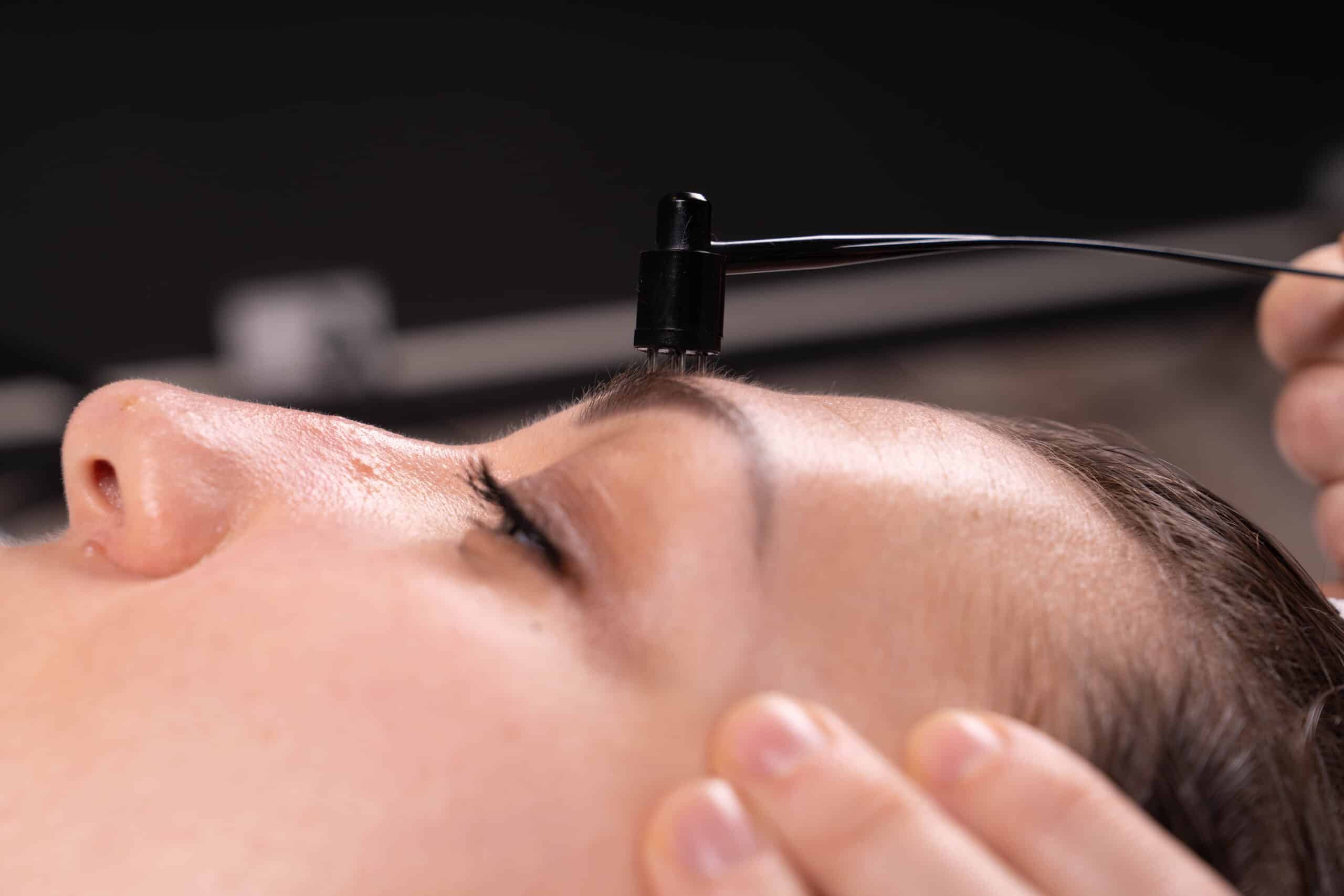 anti-aging martelletto stimolazione cutanee anti-aging martelletto stimolazione cutanee